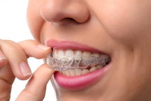 orthodontists san antonio