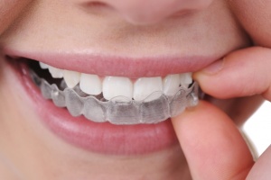 invisalign treatment san antonio