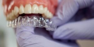 invisalign san antonio Cochran Orthodontics